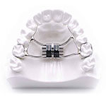 palatal expander model